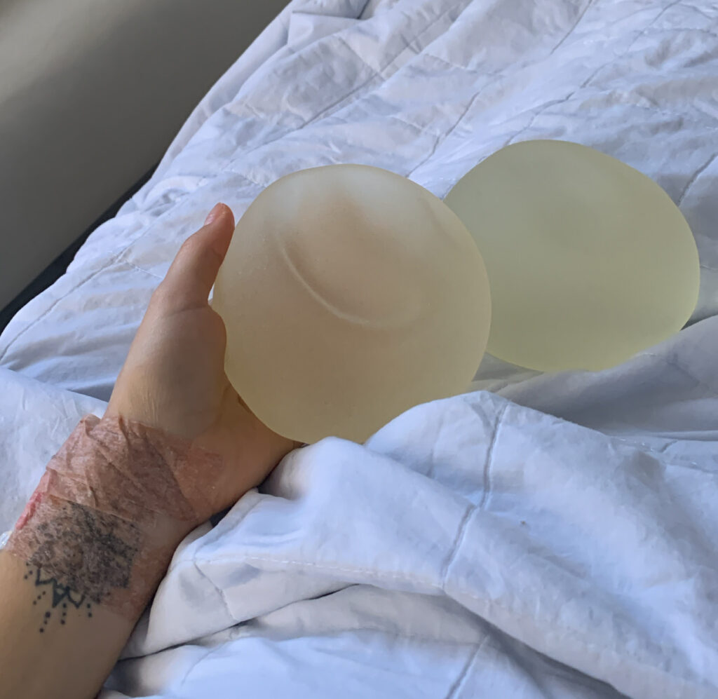 protese de silicone